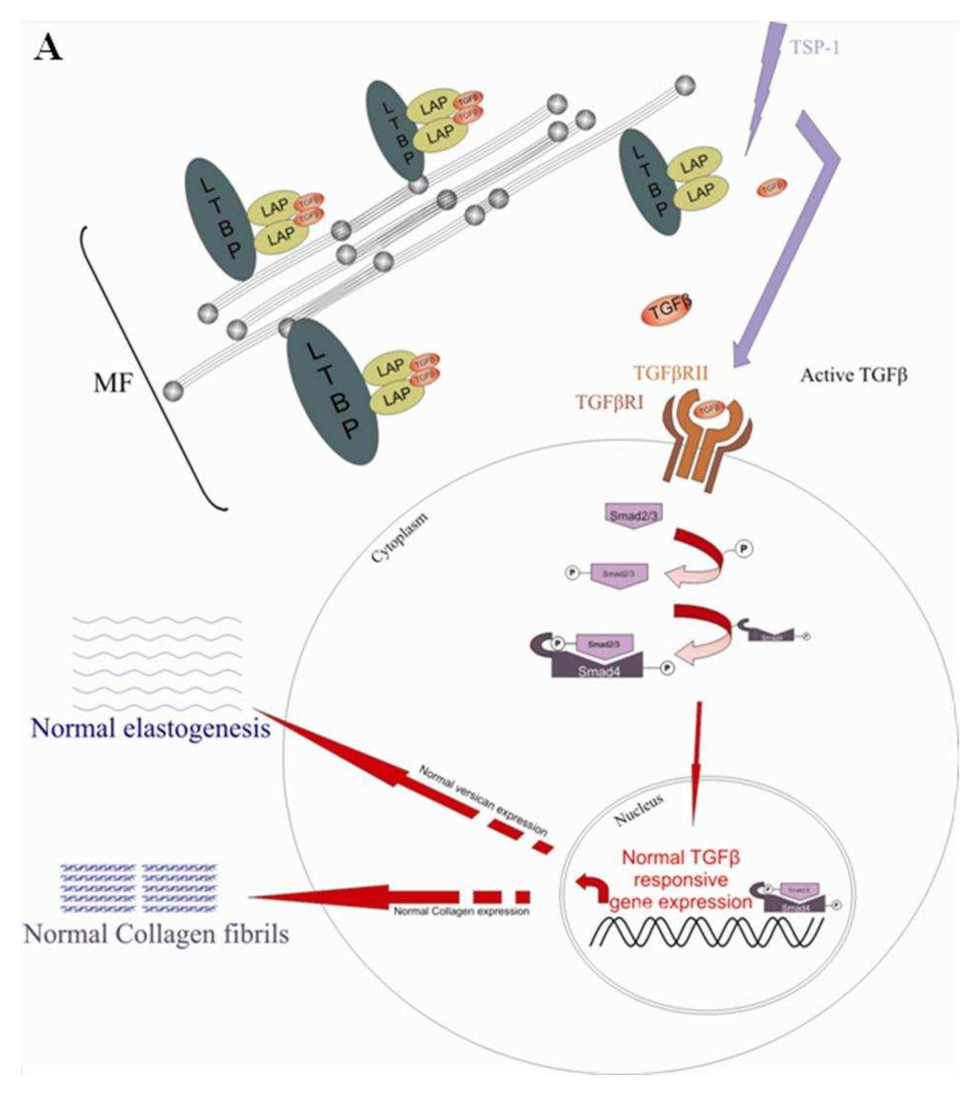 PDF) Arterial tortuosity syndrome: clinical and molecular findings