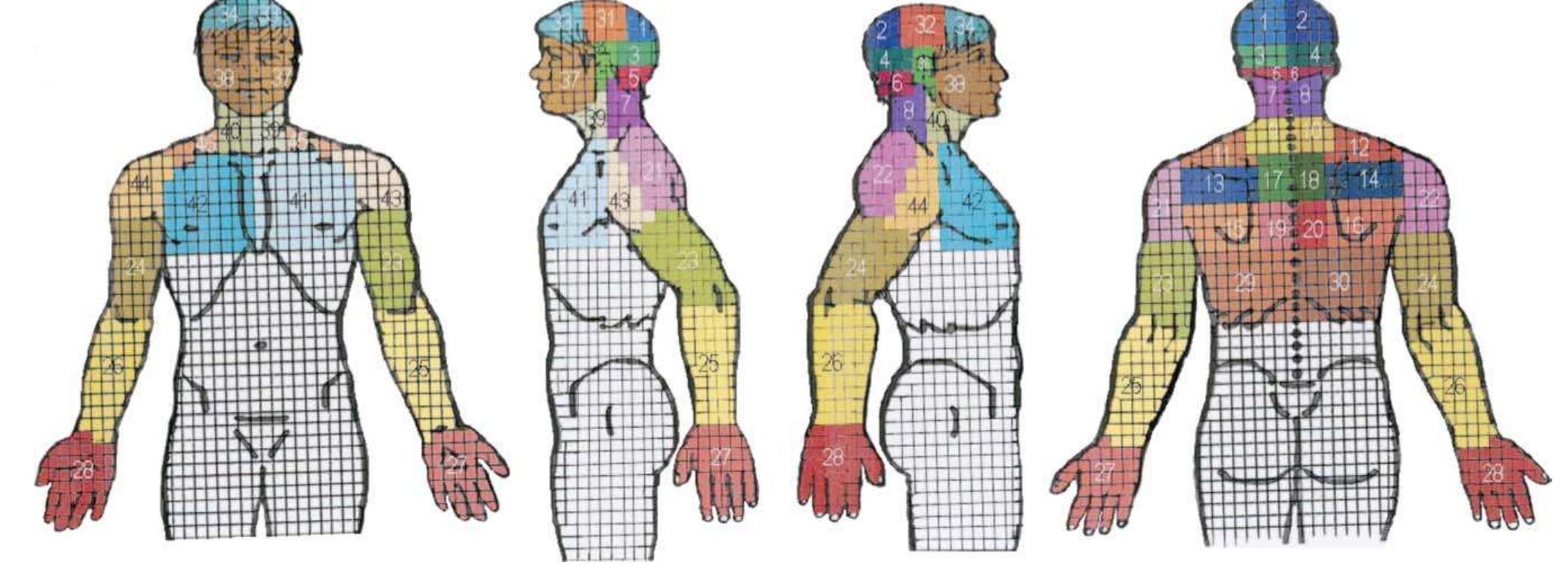 Figure 1 - from Provocative cervical discography symptom
