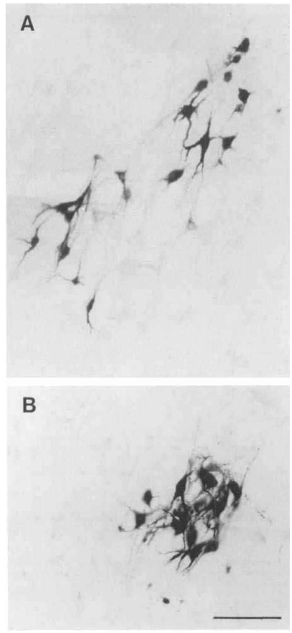 Dab Labeling Figure 1 - Innervation of the larynx, pharynx, and upper