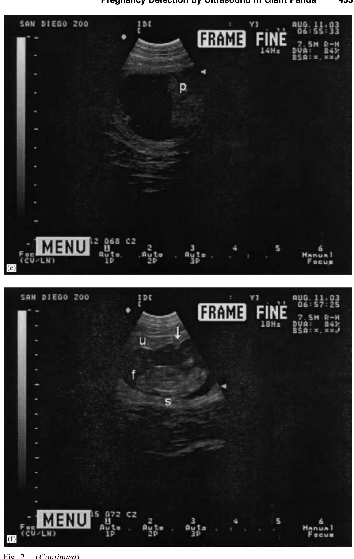 Figure 4 - Pregnancy detection and fetal monitoring via