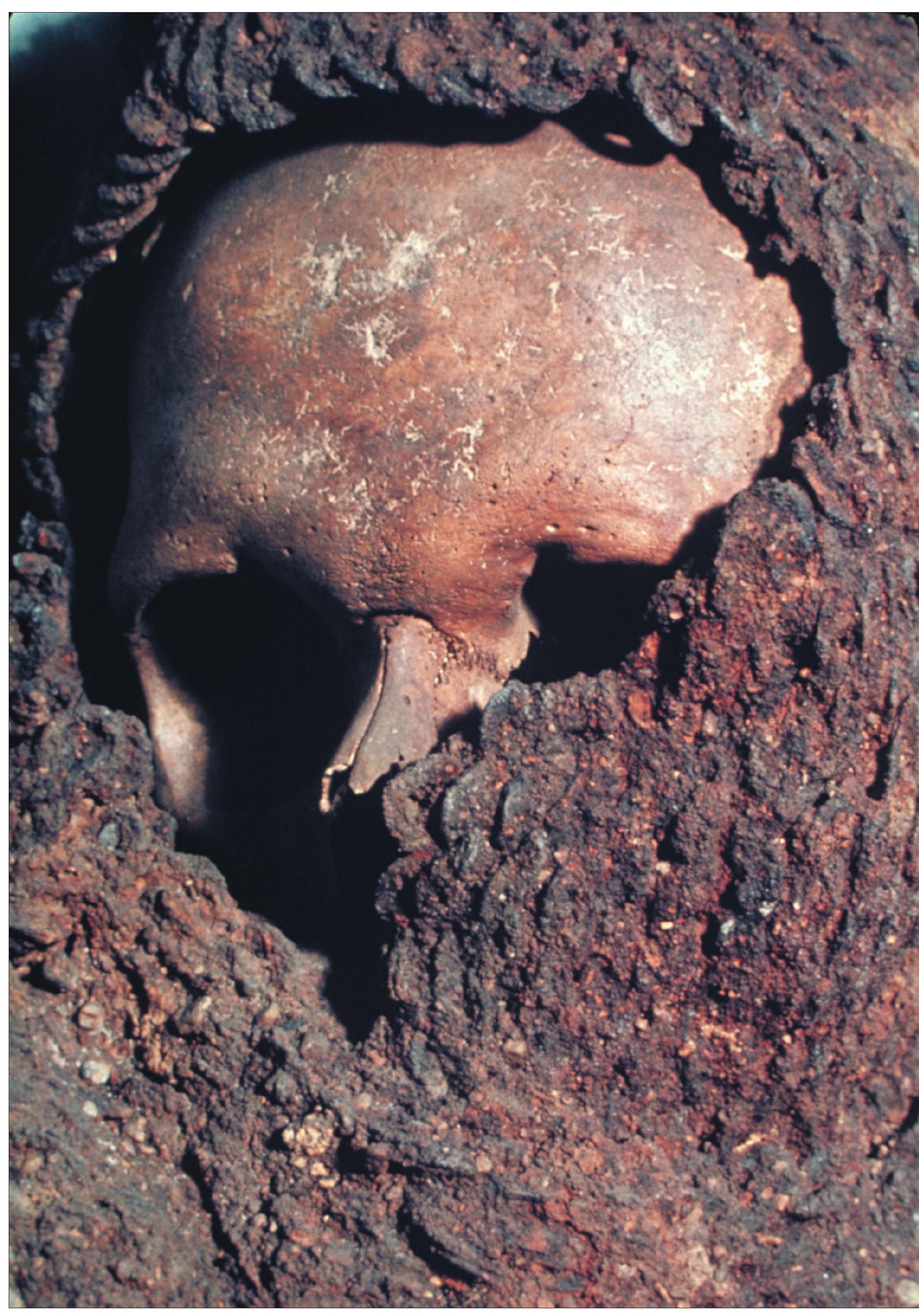 Figure 106. A warrior from Korsbetningen. Note the coif of mail surrounding the skull. Visby, Go, Inv.nr. 18872: VII1( © Statens historiska museum. 