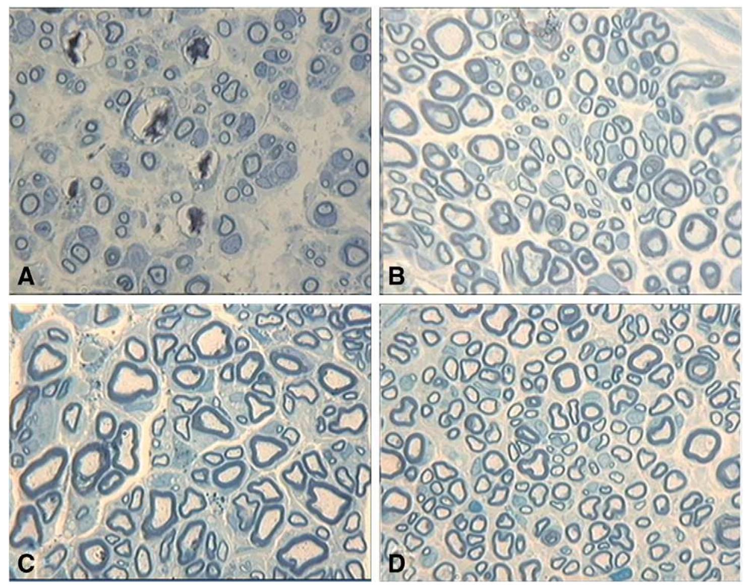 bpc-157 nerve regeneration studies BPC-157: Tendon Repair and More Regeneration or Risk? A Narrative