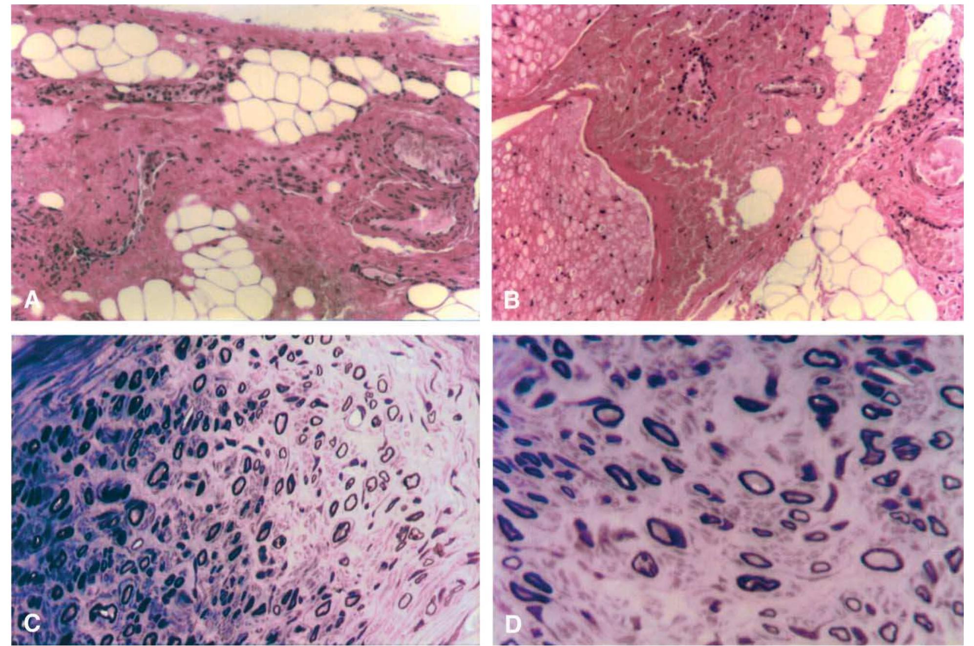 (PDF) An experimental model of peripheral nerve adhesion in rabbits