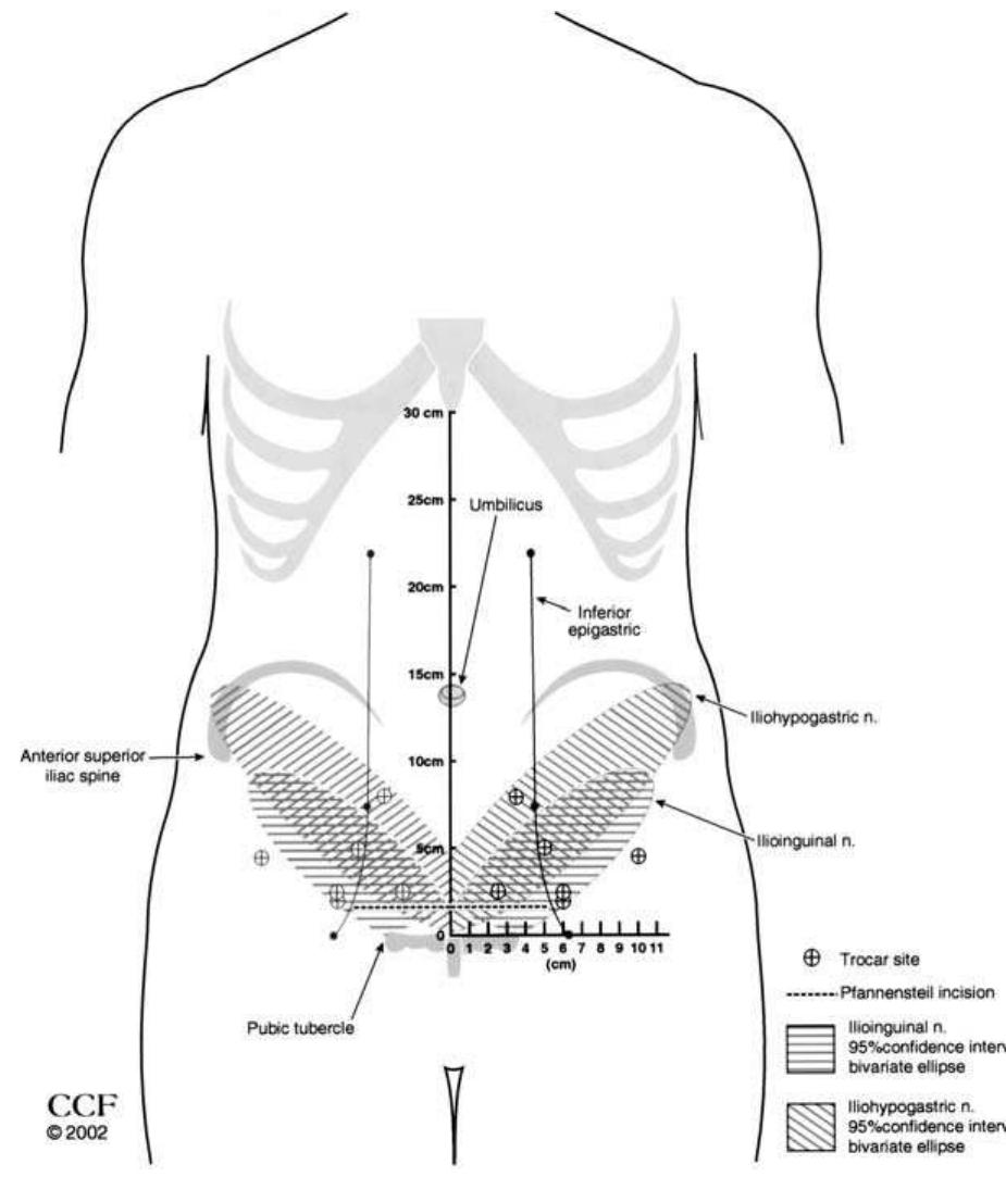 Surface view of the anterior abdominal wall with fitted