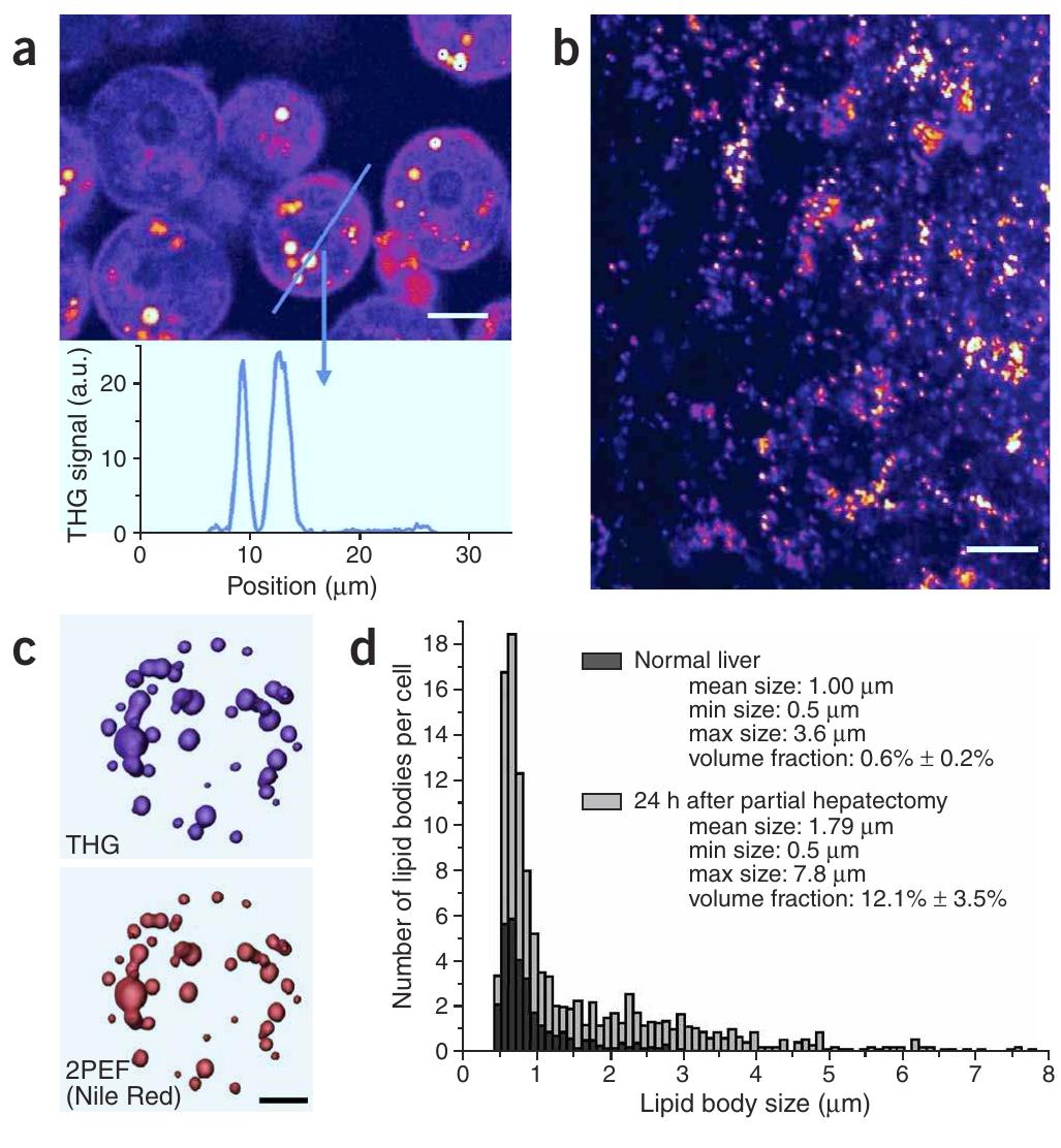 Figure 1 - Imaging lipid bodies in cells and tissues using