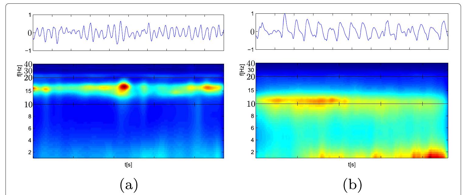 Log Log Plot Eeg Example (PDF) EEG Rhythm Extraction Based on Relevance Analysis and Customized ...