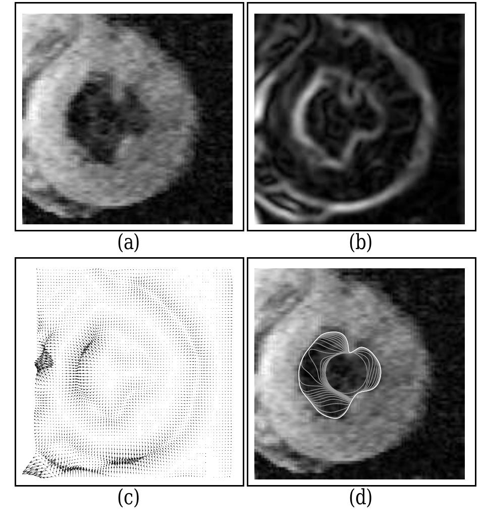 (PDF) Gradient vector flow: a new external force for snakes