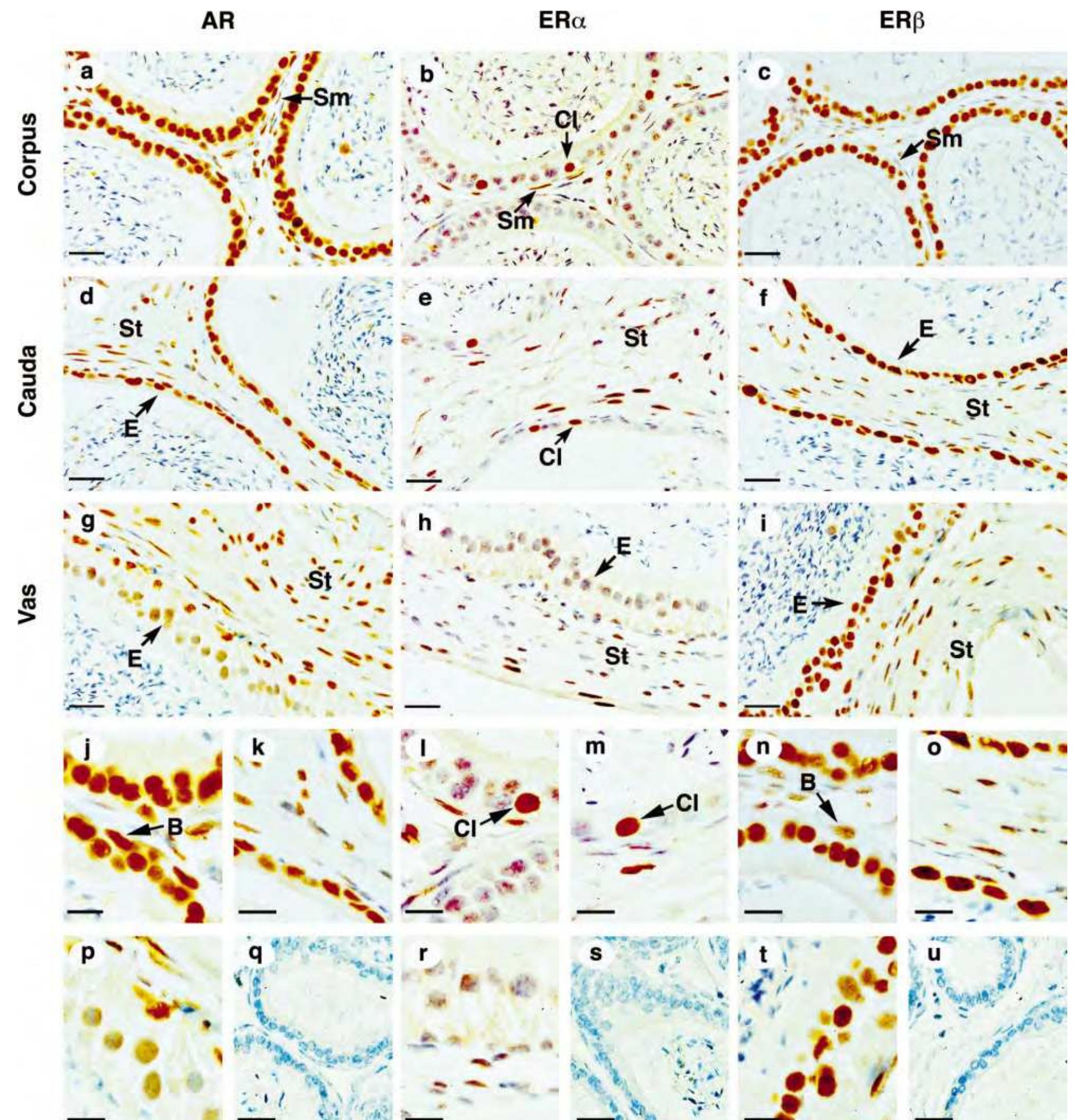 Immunostaining of ar, era, and er in mouse testis (a-c, m,