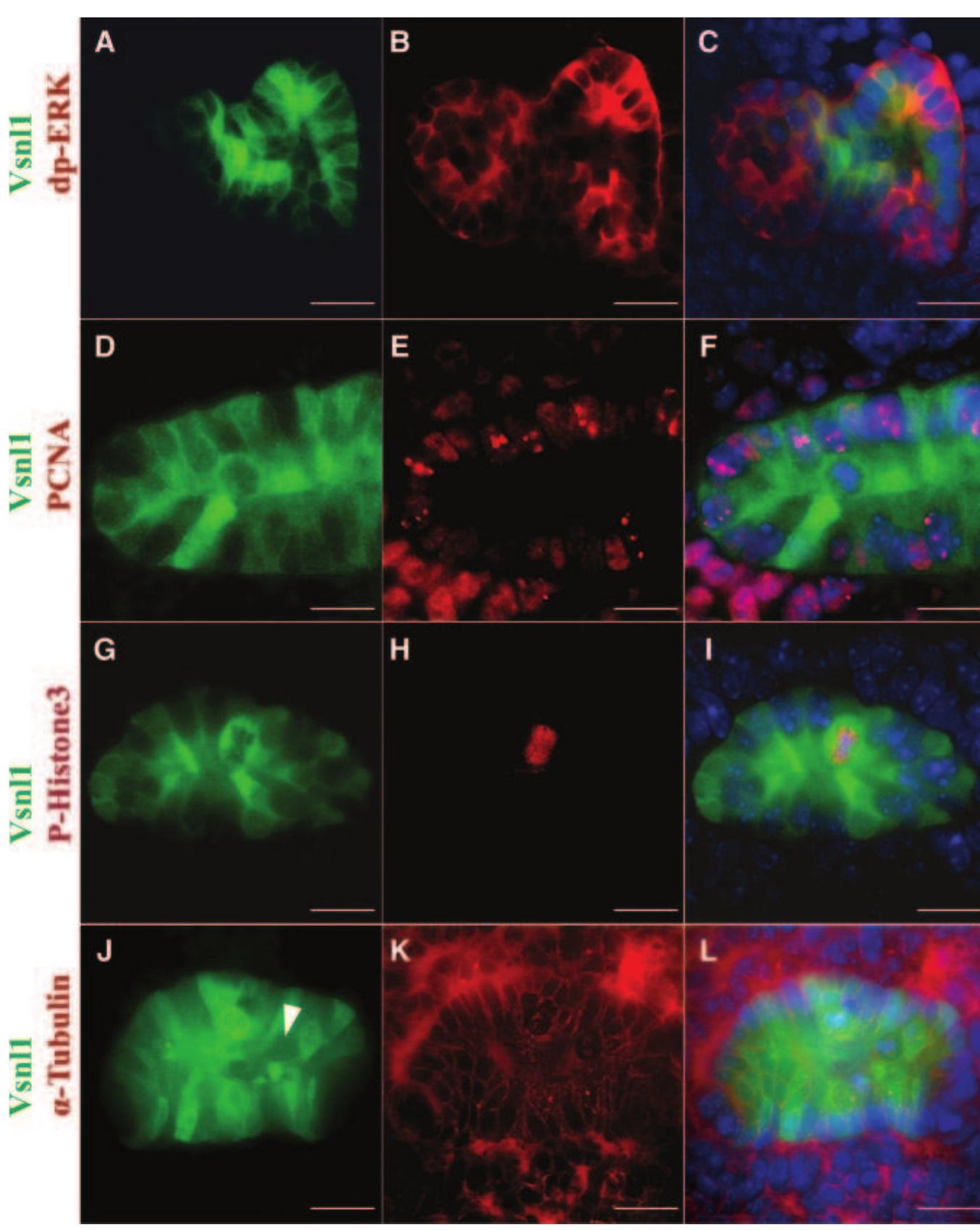 Vsnl Figure 1 - The GDNF Target Vsnl1 Marks the Ureteric Tip