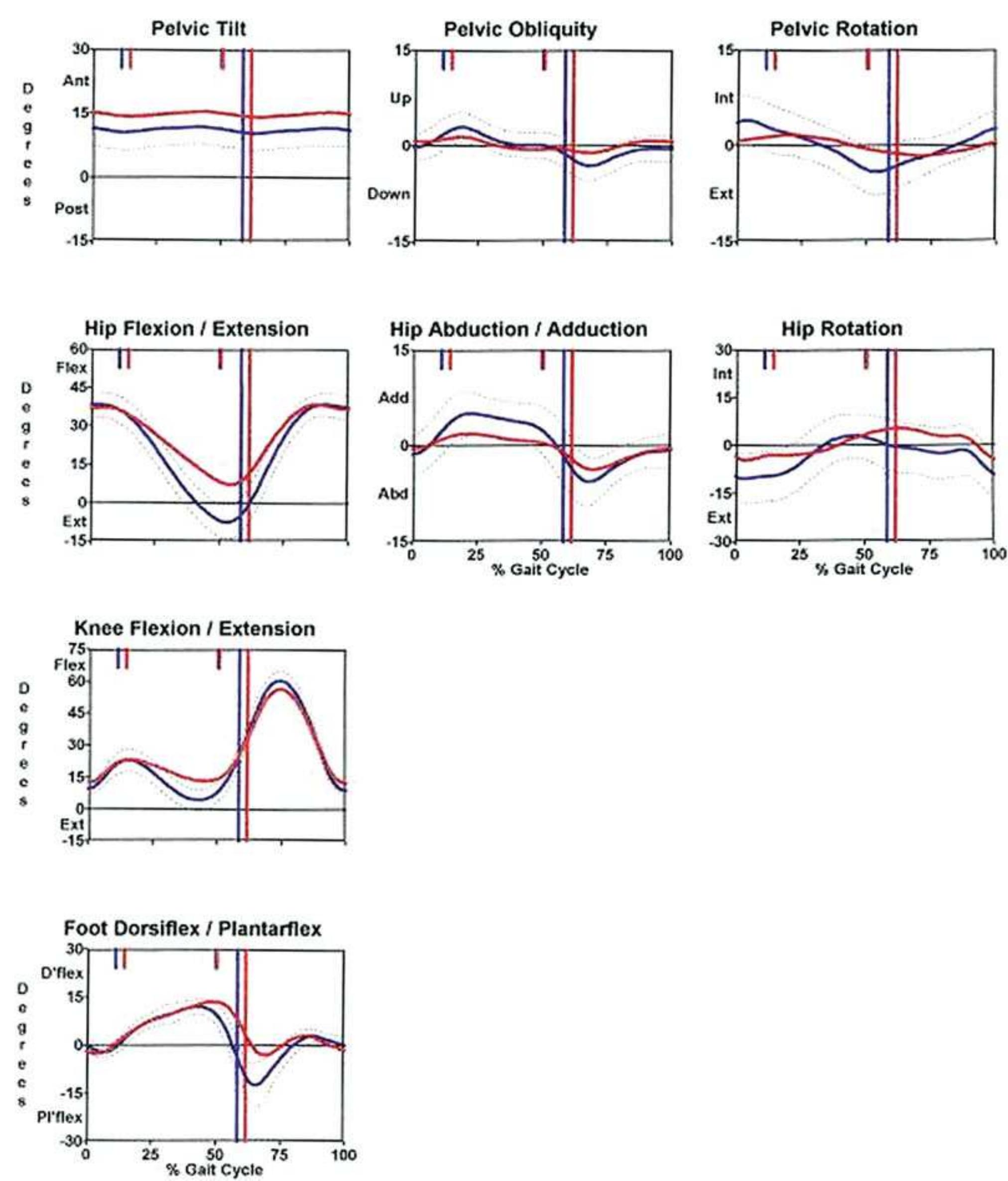 Pelvis, hip, knee, and ankle kinematic profiles of the