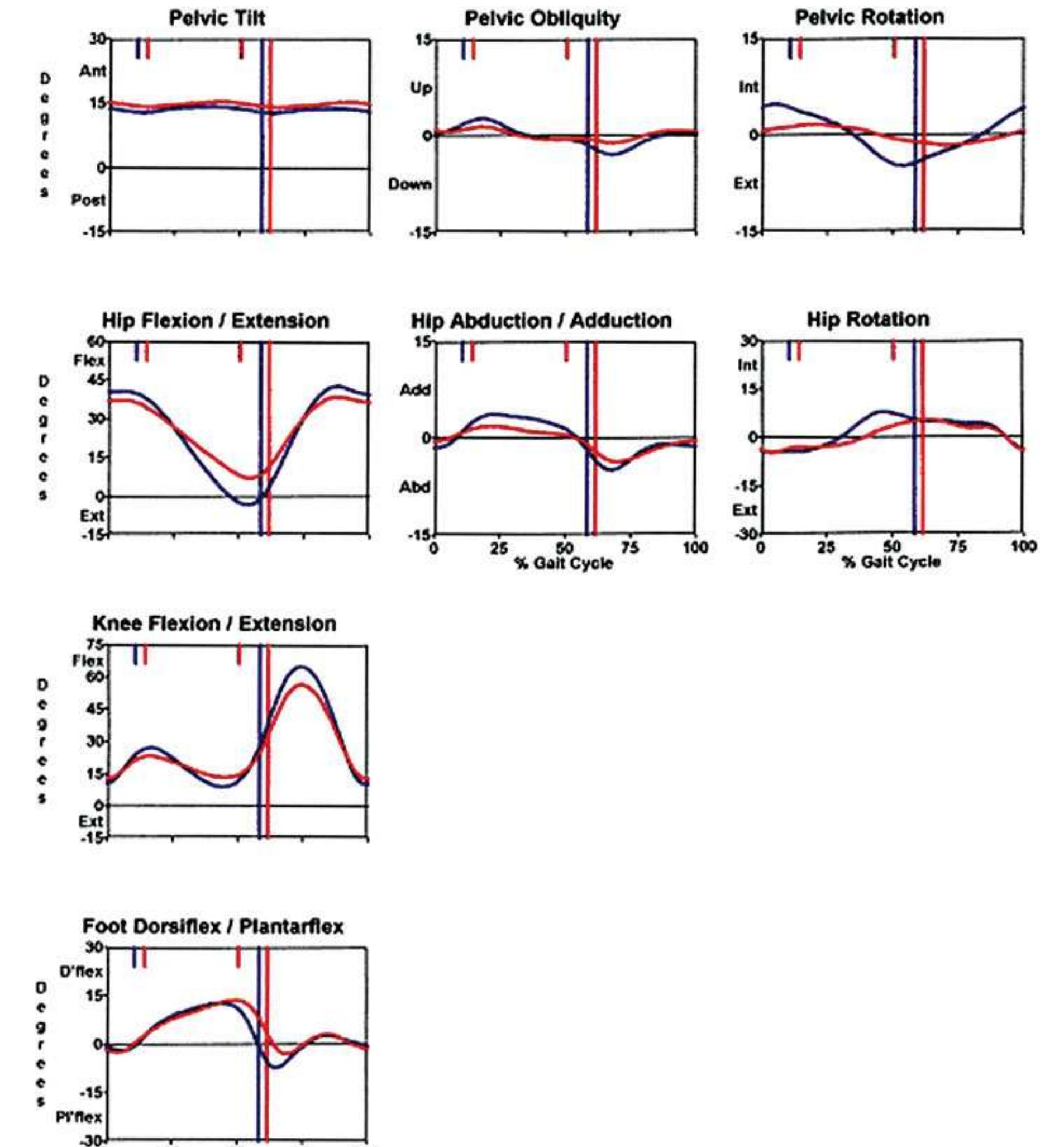 Pelvis, hip, knee, and ankle kinematic profiles of the