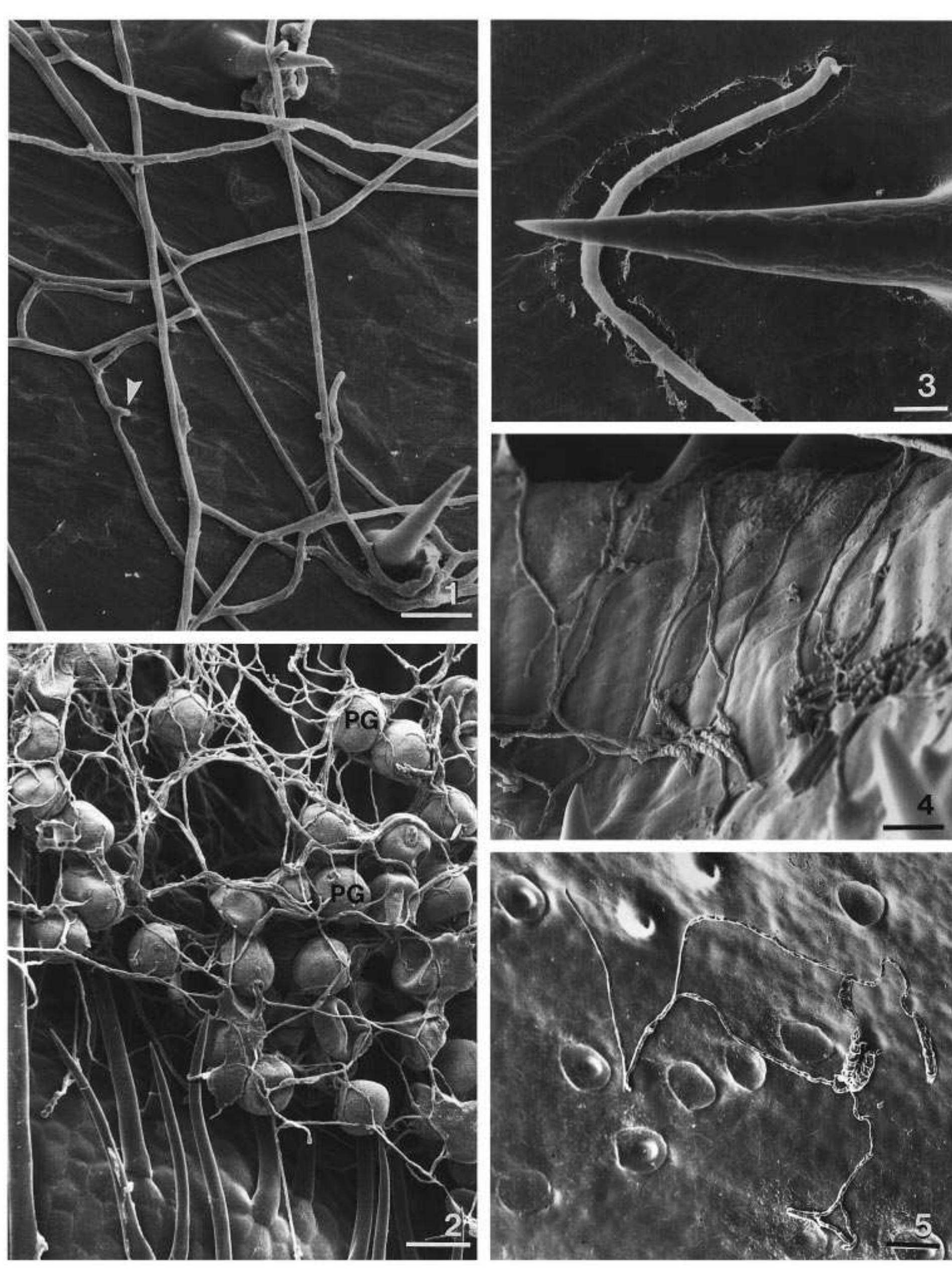 Figure 2 - from The infection biology of Fusarium