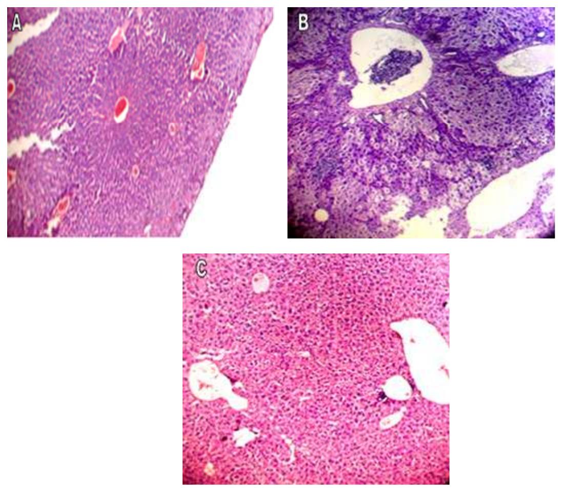 Histopathological changes in the liver before and after 30-