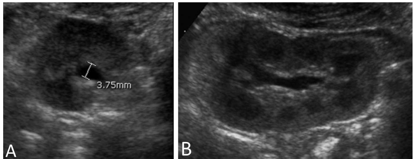 (PDF) Multidisciplinary consensus on the classification of prenatal and ...
