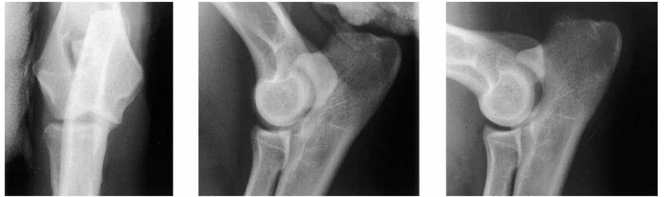 Cranio-caudal (left), extended lateral (center), and 90°