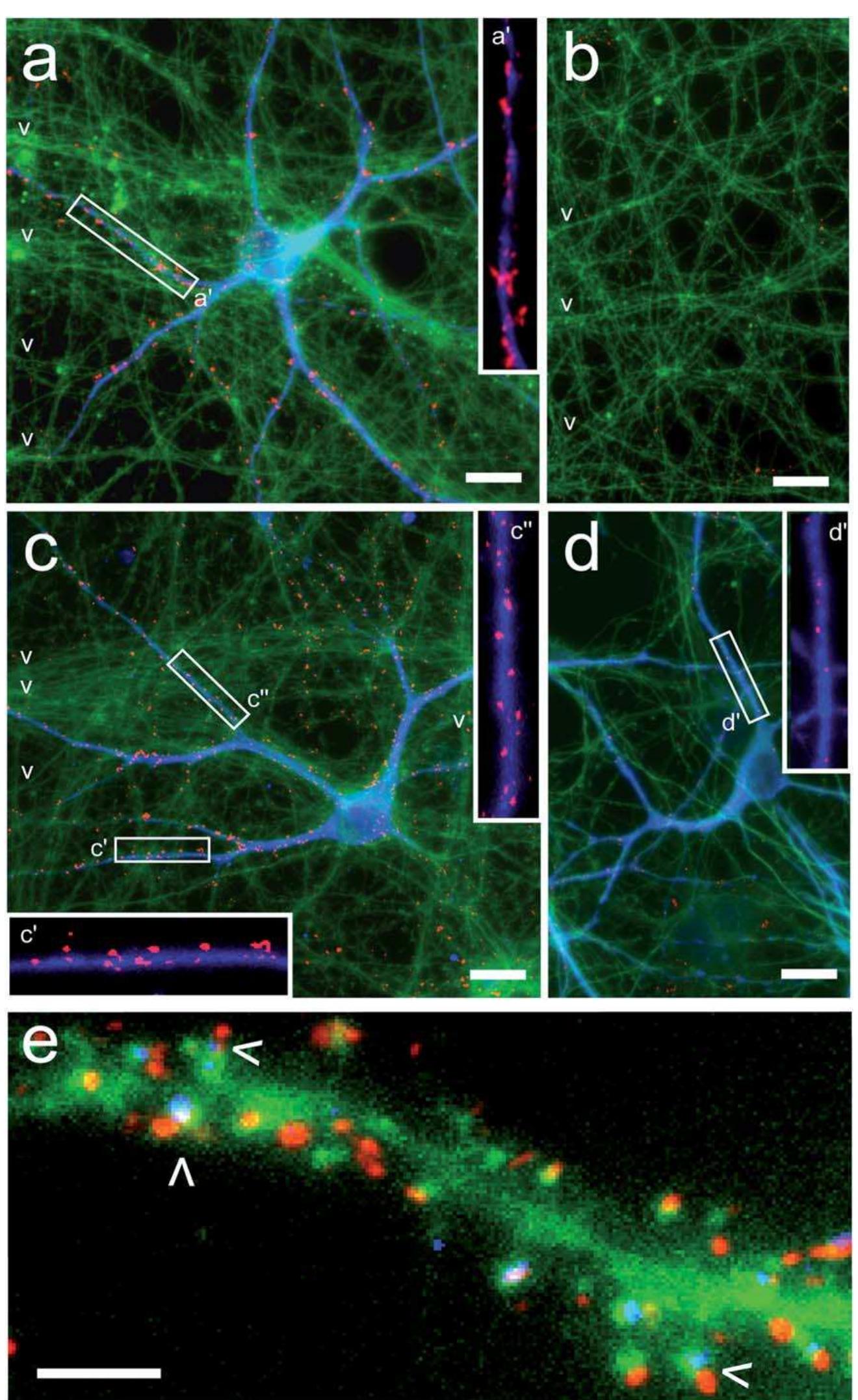 (PDF) Axon diodes for the reconstruction of oriented neuronal networks ...