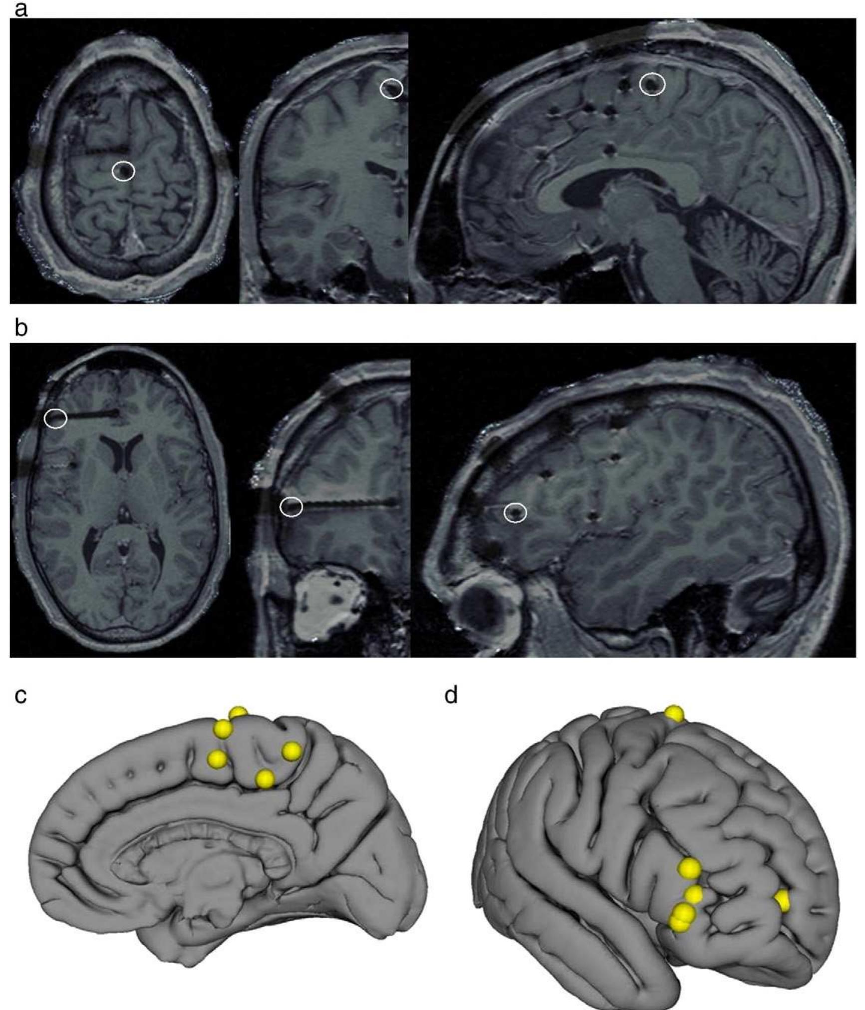 (PDF) Dissociated wake-like and sleep-like electro-cortical activity ...