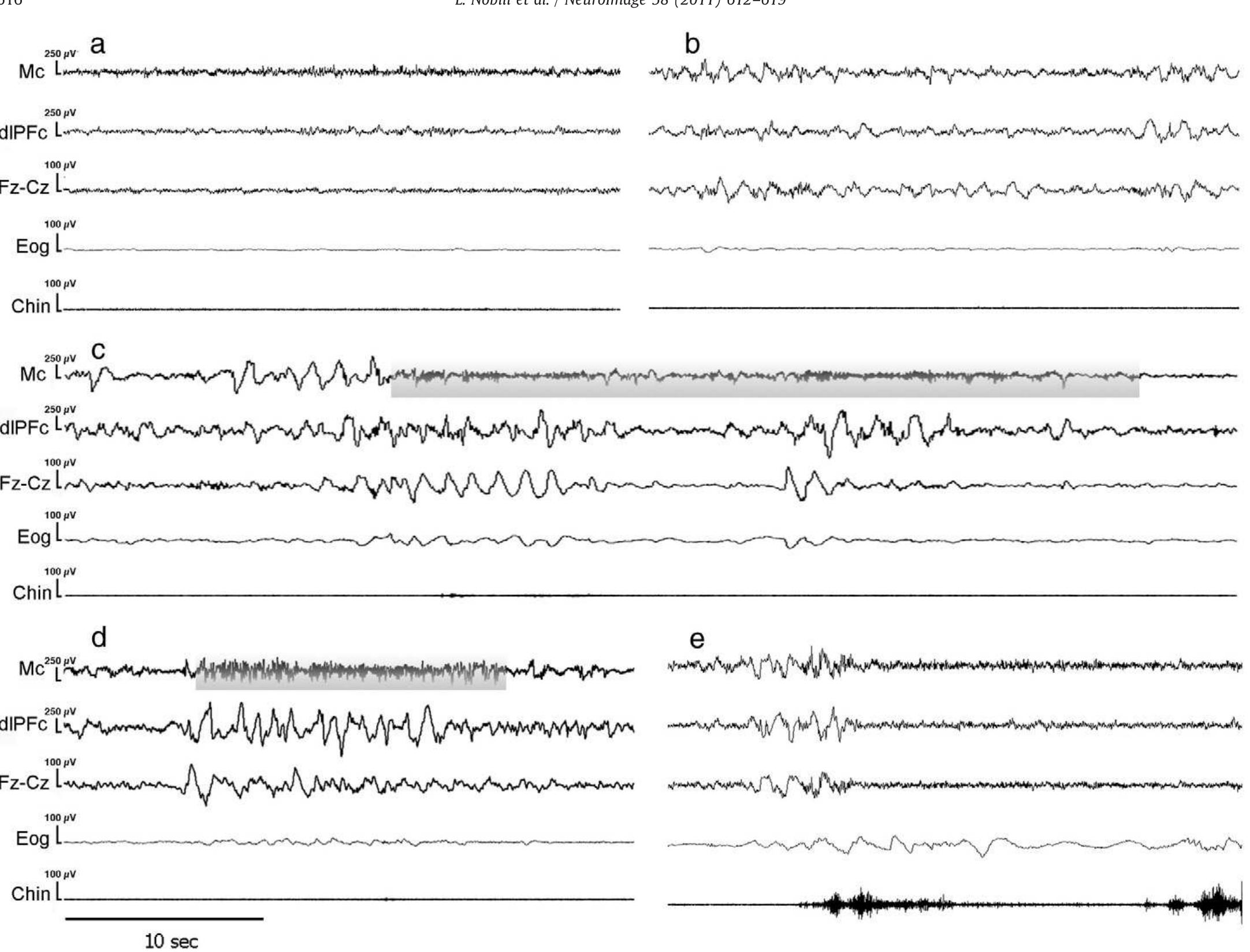 (PDF) Dissociated wake-like and sleep-like electro-cortical activity ...