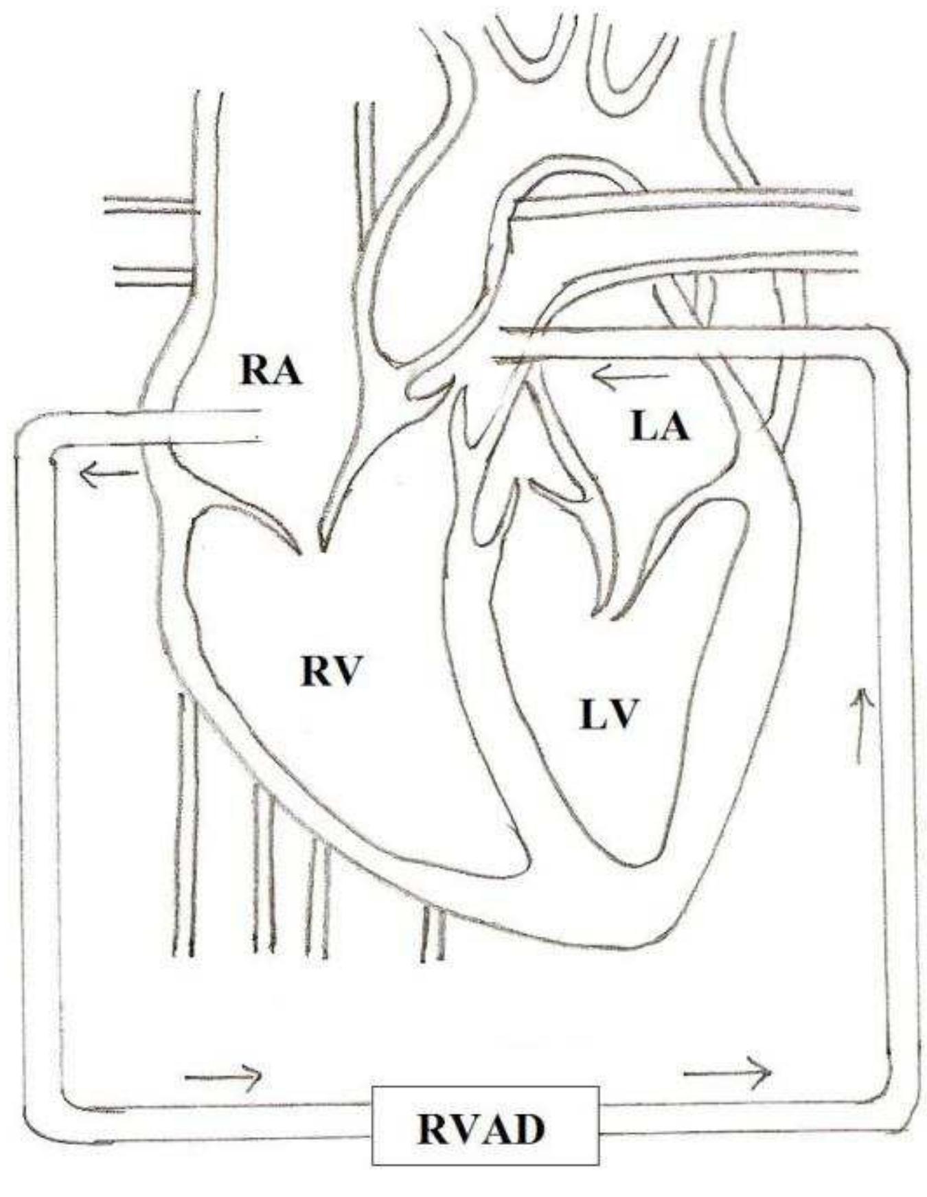 Figure 58 - from DESIGN AND DEVELOPMENT OF A PULSATILE AXIAL