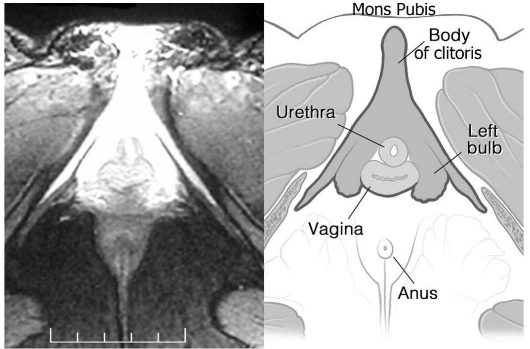 (PDF) Anatomy of the Clitoris