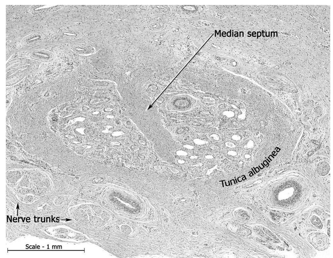 Figure 6 - from Anatomy of the Clitoris