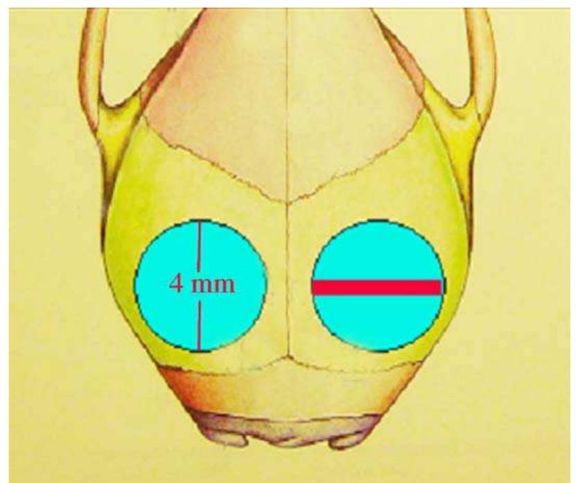 (PDF) Silk implants for the healing of critical size bone defects