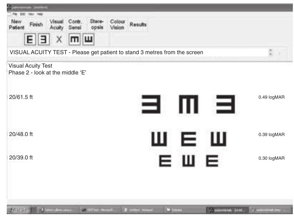 (PDF) Automated determination of distance visual acuity: towards ...