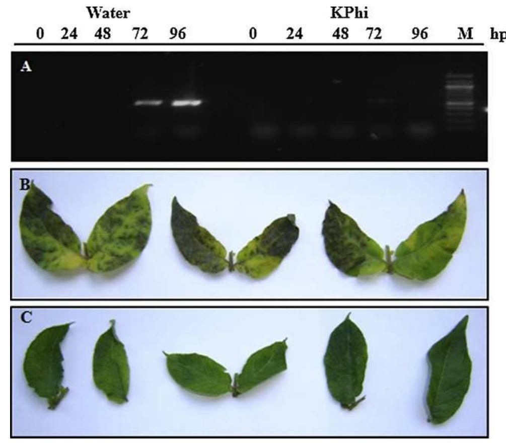 Fig. 1. Effect of KPhi on induced resistance against Phytophthora infestans. (A) P. infestans biomass detection by RT-PCR on potato leaves. Amplification products of primer set ITS1 and ITS2 and template DNA leaves infected with P. infestans from water- or KPhi-treated plants. Symptoms of P. infestans infection on leaves from (B) water-treated and (C) KPhi-treated plants, 7 days post-inoculation. hpi: hours post-inoculation. M: molecular markers. 
