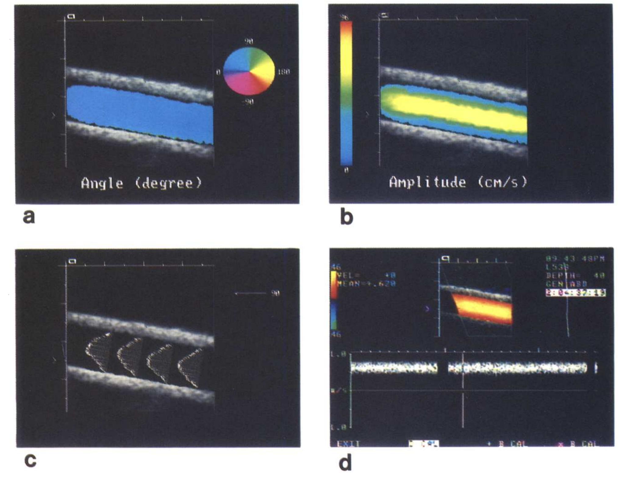 Figure 3 - from Angle independent doppler color imaging: