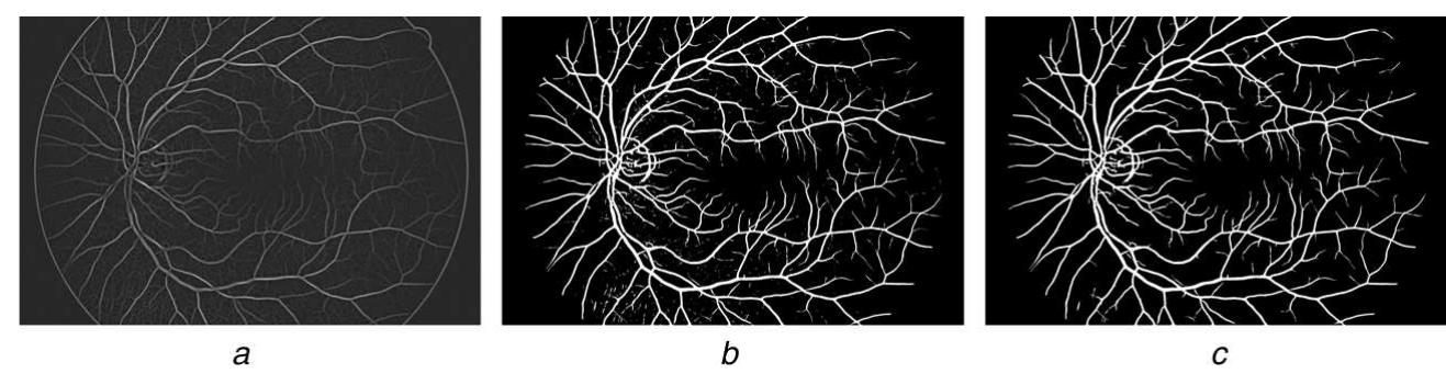 Figure 4 - from Retinal vessel segmentation by improved
