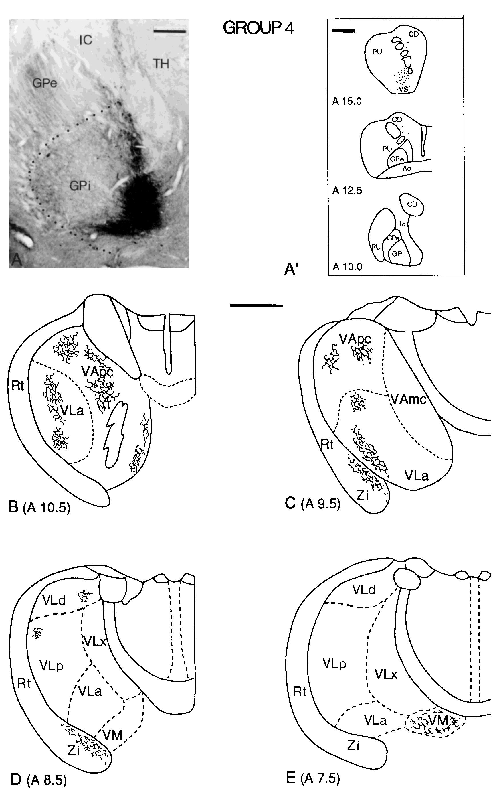 Schematic drawings of transverse sections through the