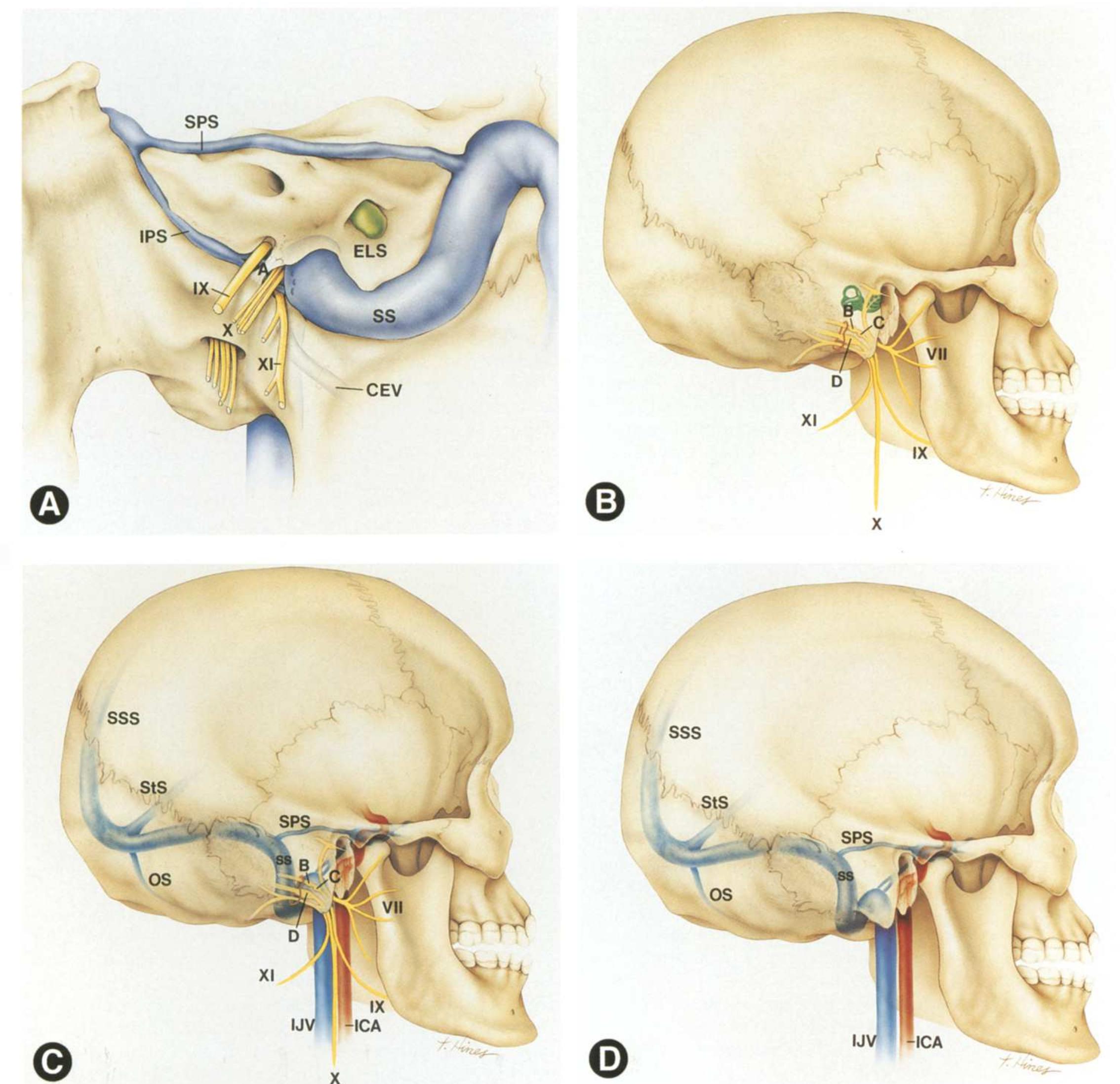 Sadgital Ridge Figure 18 - from Pictorial review: Radiology of the jugular