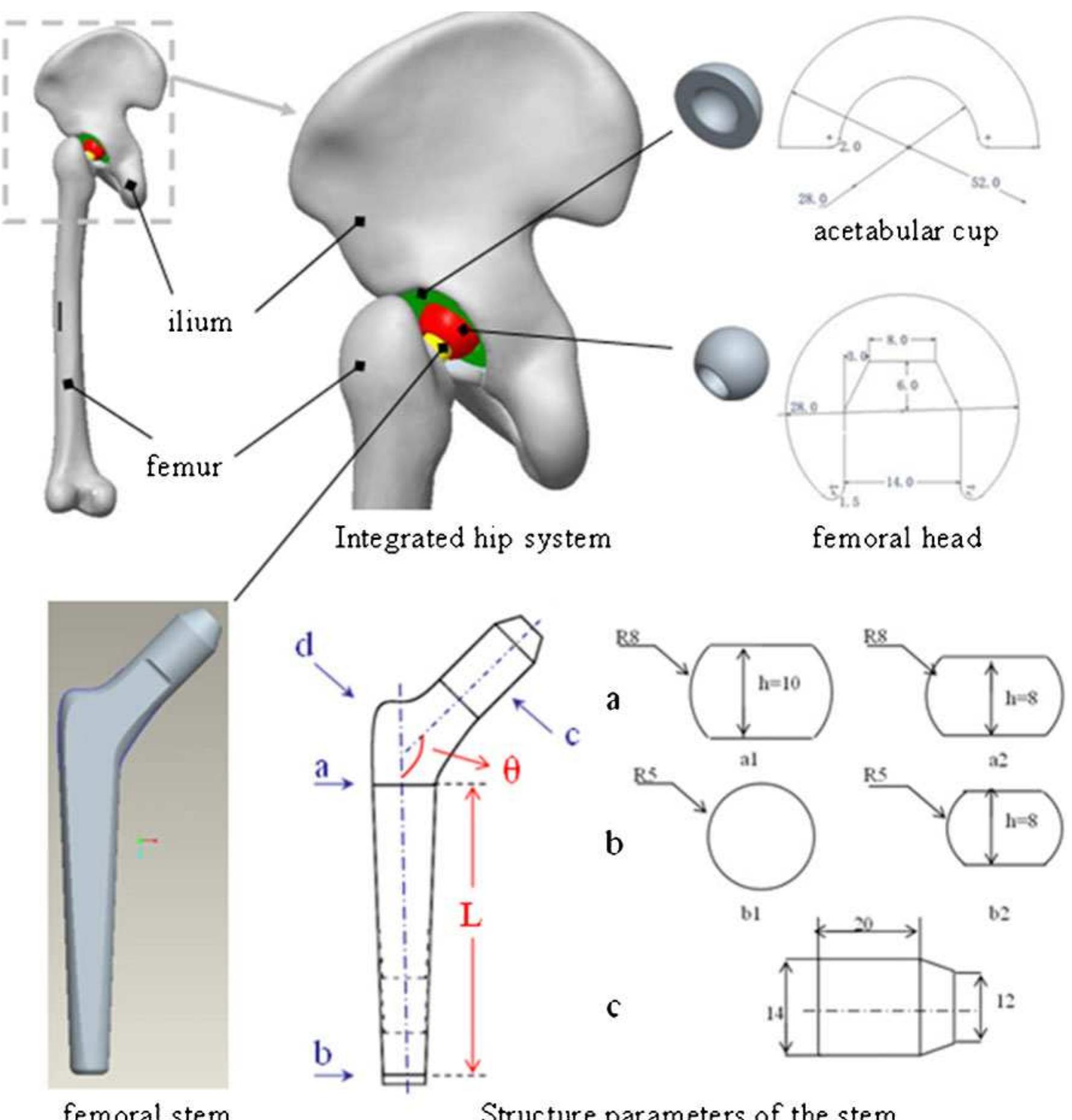 The integrated model of the hip system was im- ported into