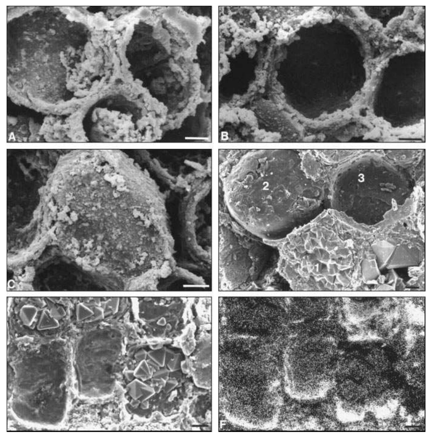 -igure 1. a, b, c: secondary scanning electron microscope