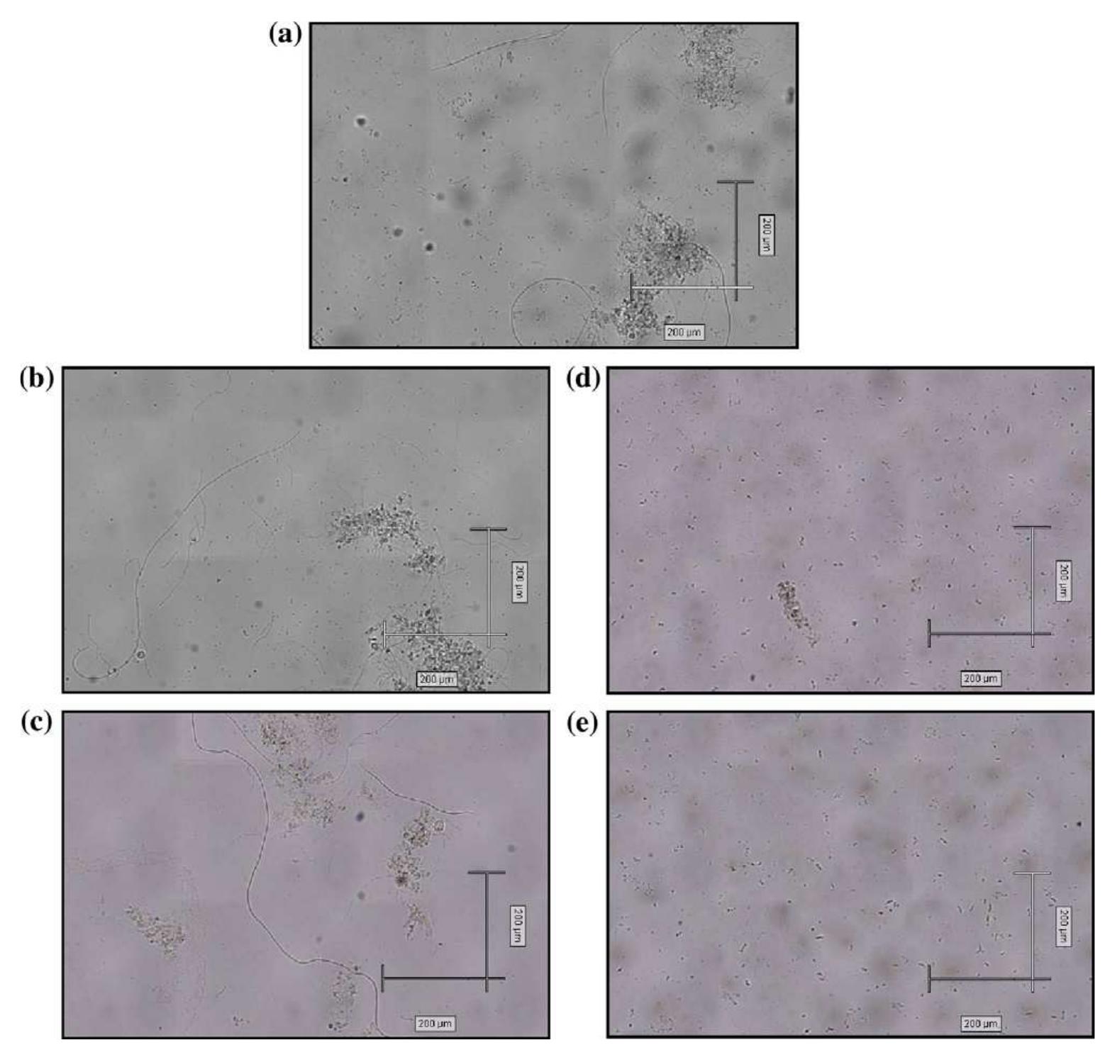 Microscopic appearance of the activated sludge flocs before