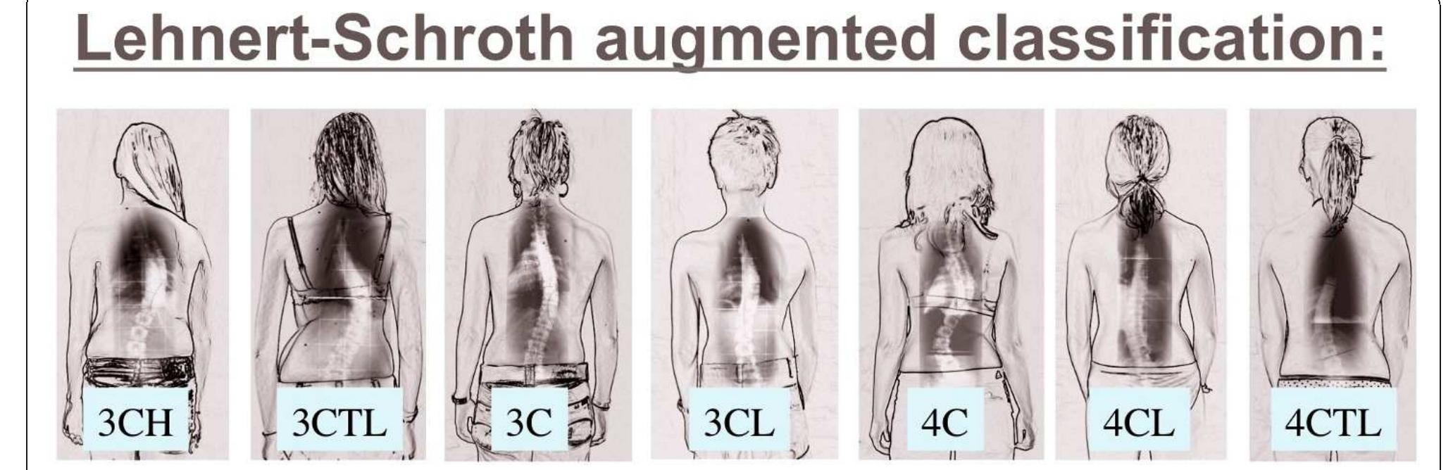 Figure 27 - from The method of Katharina Schroth -history,