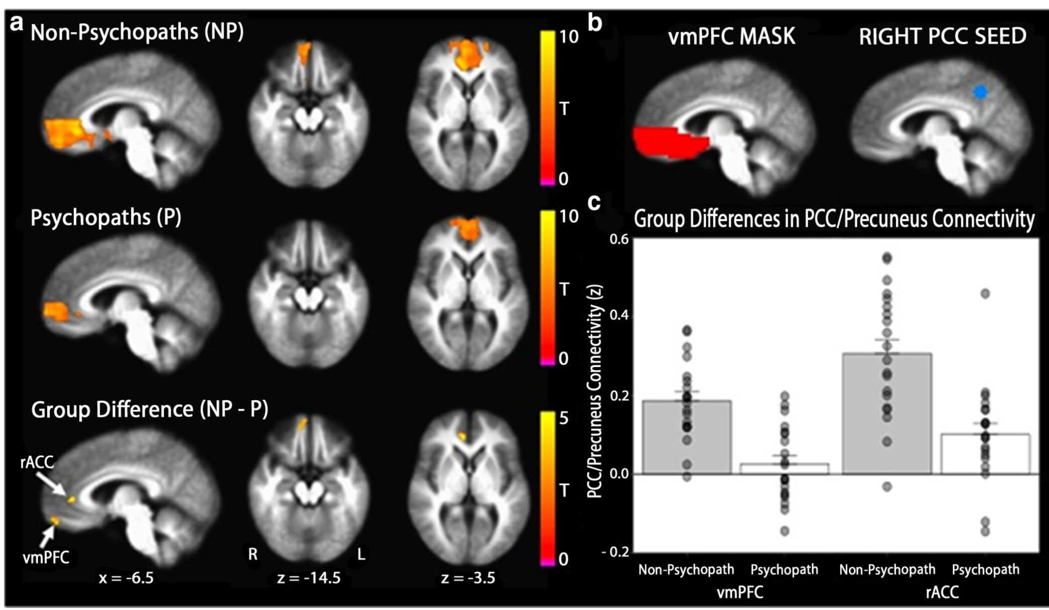 Figure 3 - from Reduced Prefrontal Connectivity in