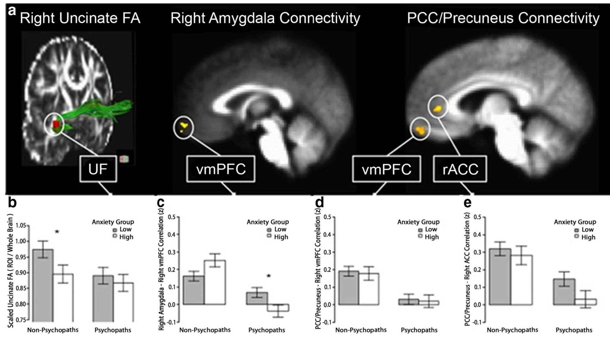 Figure 4 - from Reduced Prefrontal Connectivity in