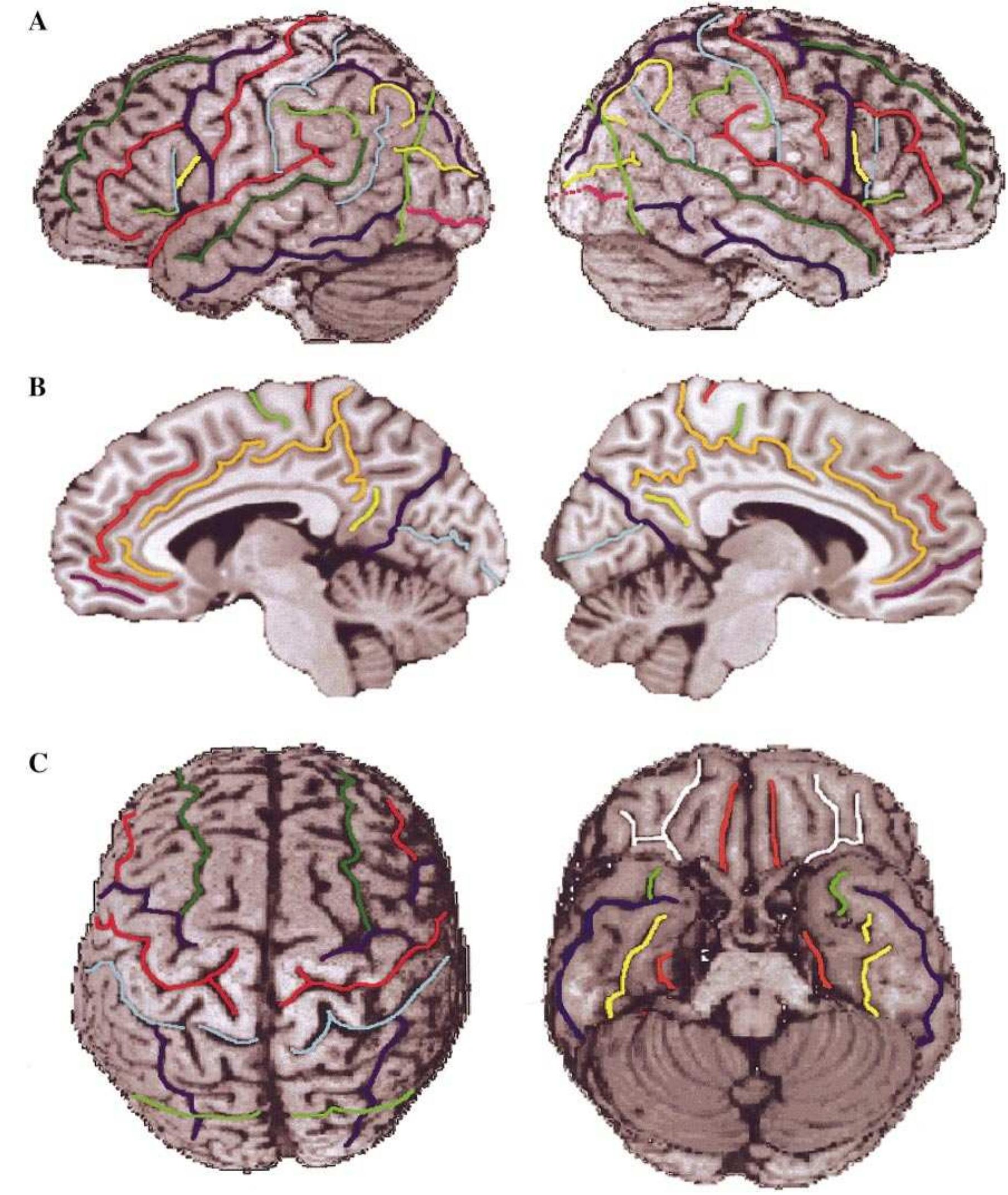 (PDF) Automated anatomical labeling of activations in