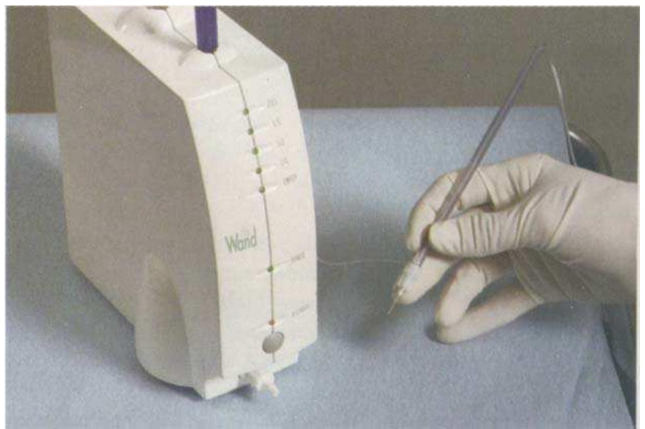 (PDF) P-ASA Block Injection: A New Palatal Technique to Anesthetize ...