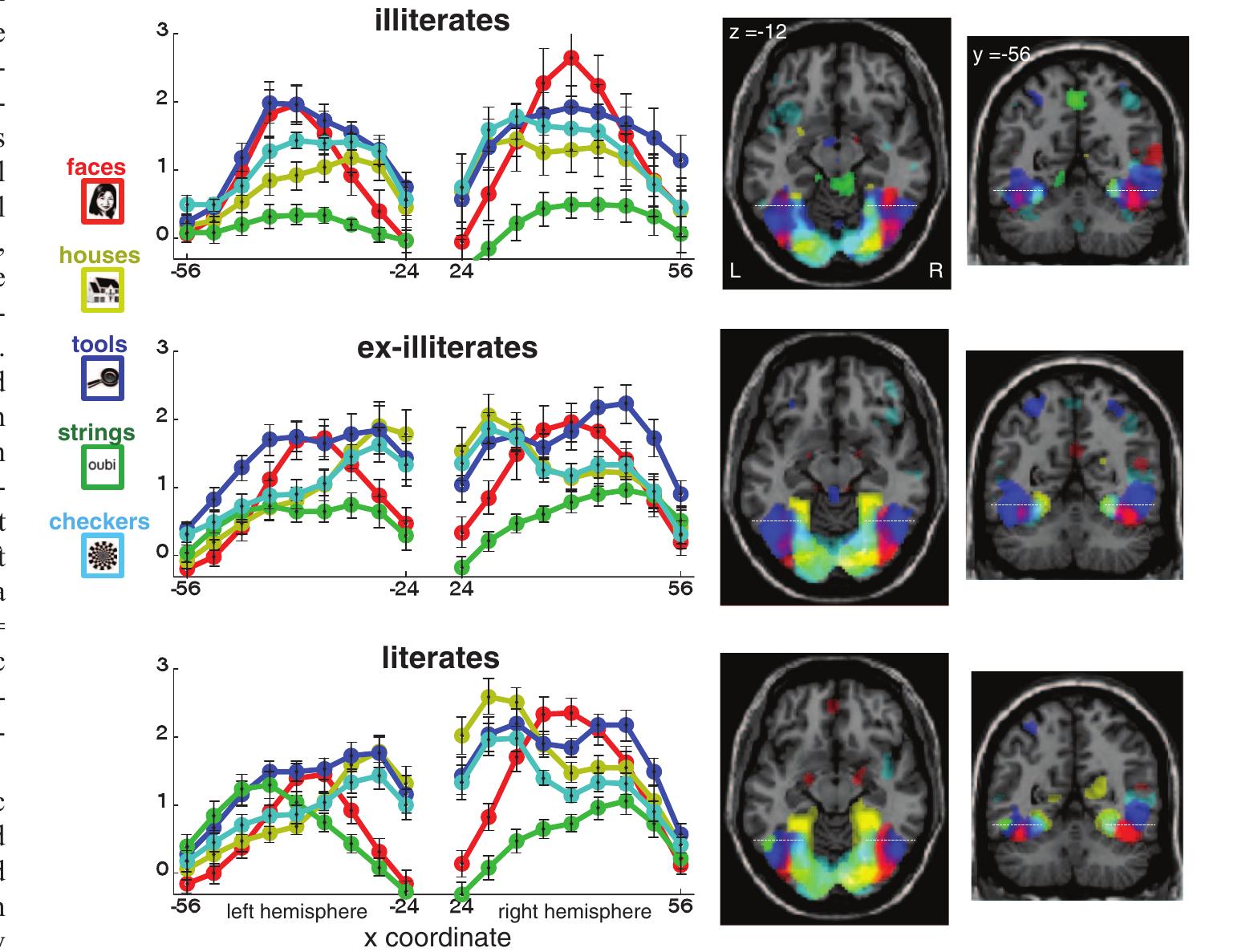 (PDF) How Learning to Read Changes the Cortical Networks for Vision and ...