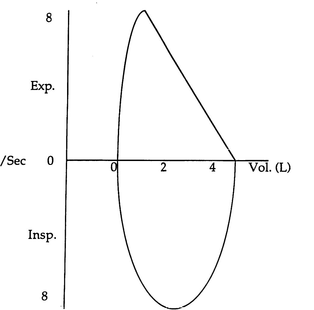 Fic. 1. normal flow volume loop curve showing the