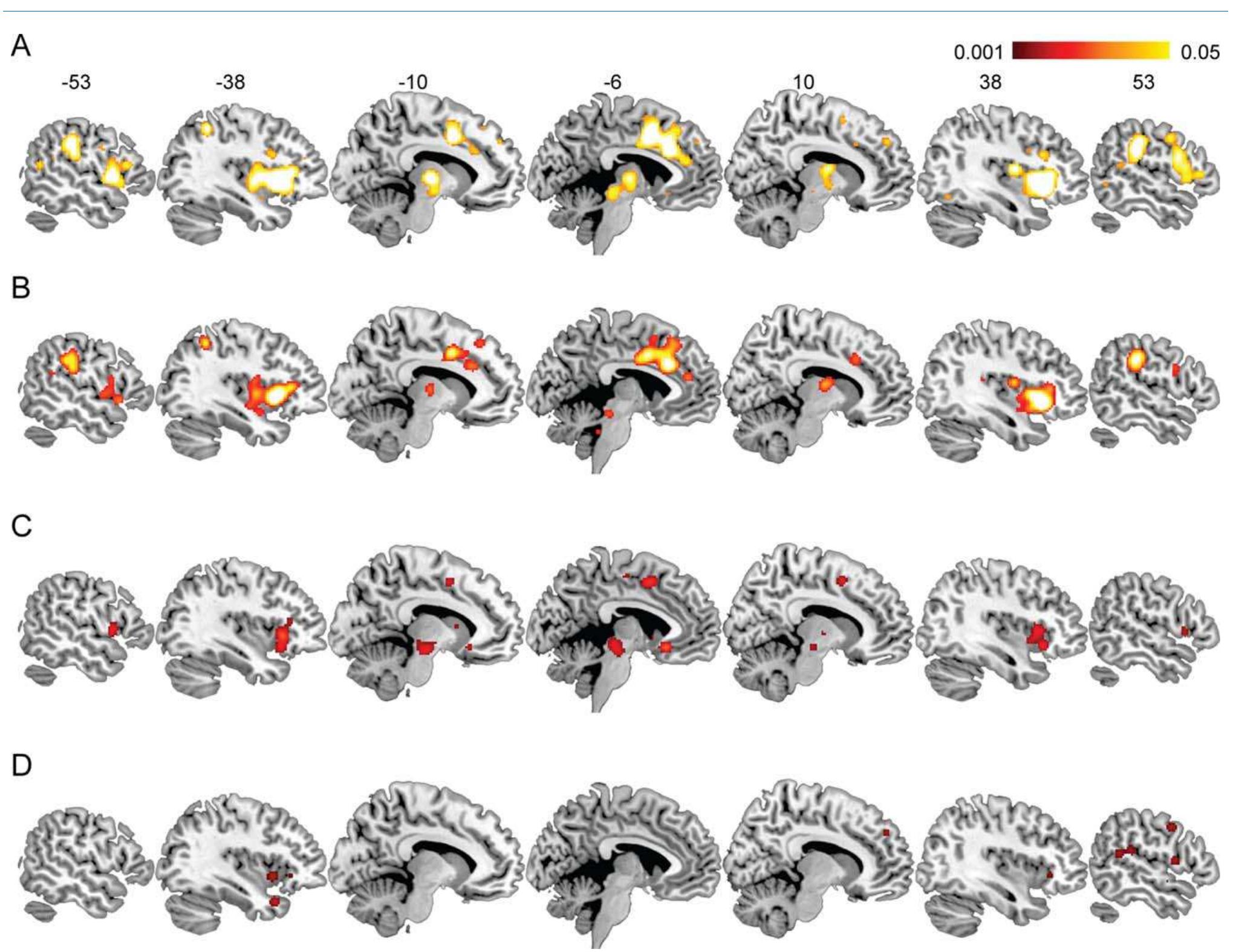 Figure 1 - from Anterior insular cortex and emotional