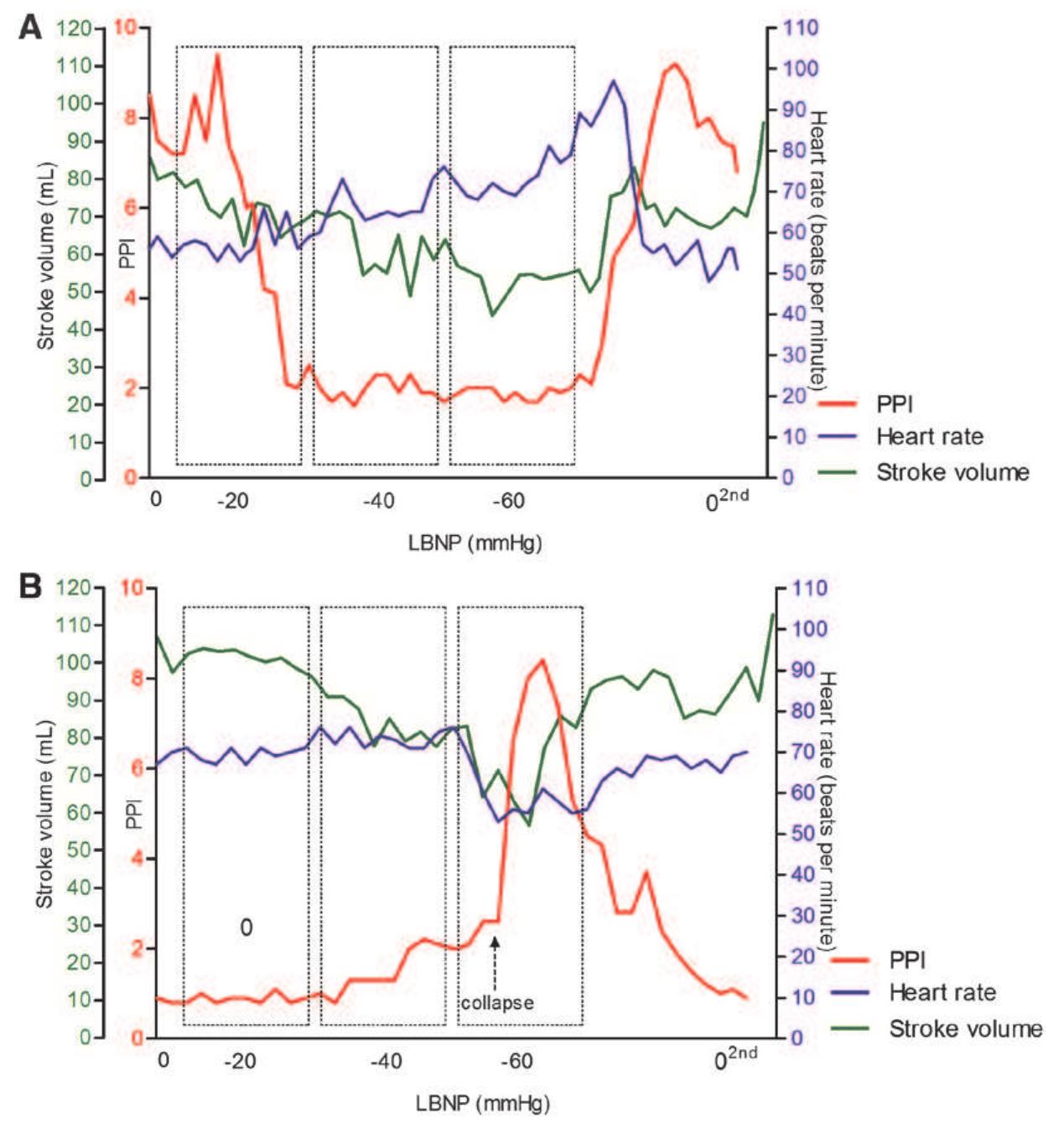 (PDF) Peripheral Perfusion Index as an Early Predictor for Central ...