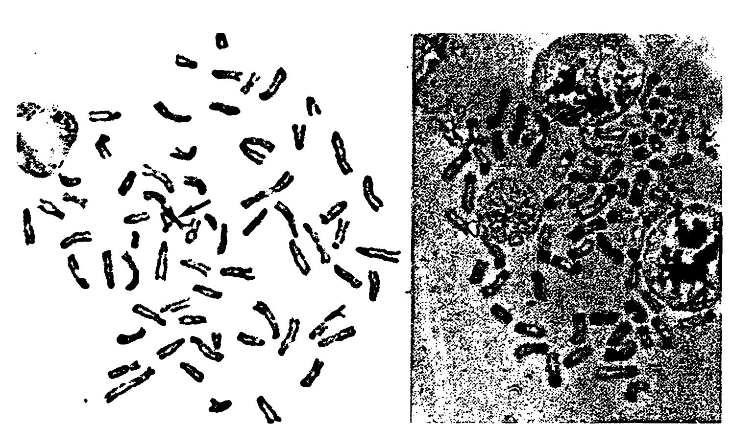Calomys (PDF) Karyotype, morphology and taxonomic Status of Calomys expulsus ...