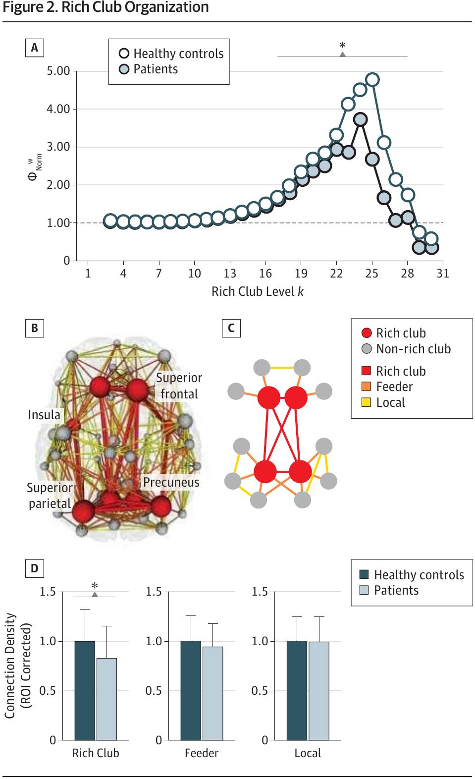 (PDF) Abnormal Rich Club Organization and Functional Brain Dynamics in ...