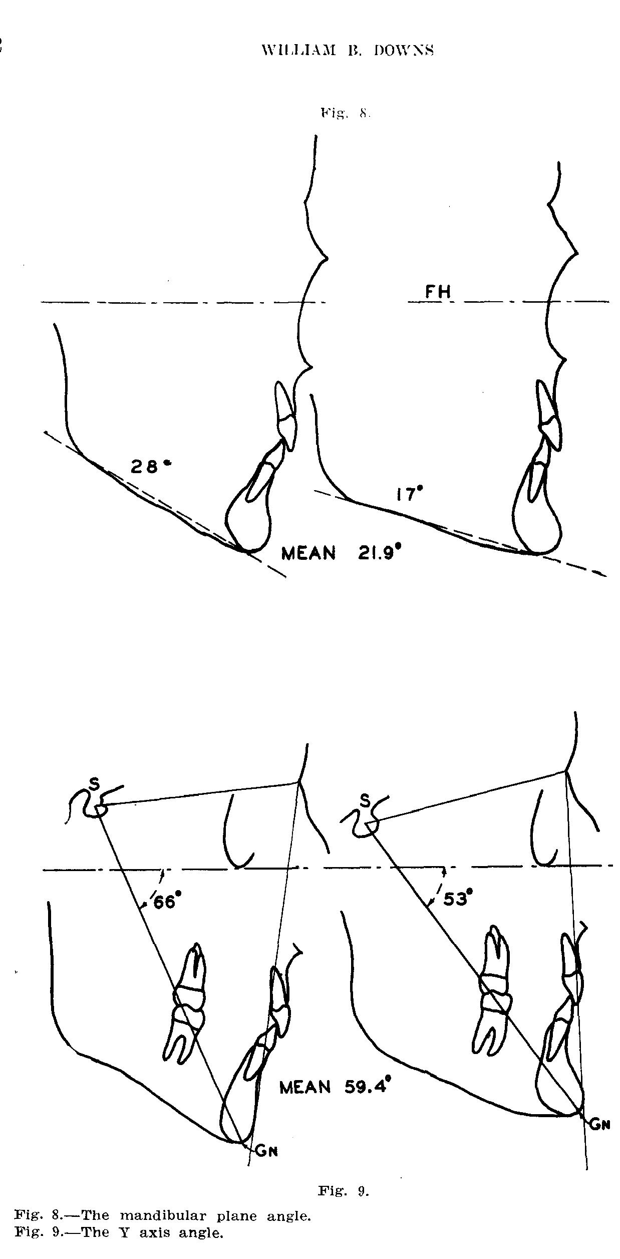  ig 8 the mandibular plane angle ig 9 the y axis angle 