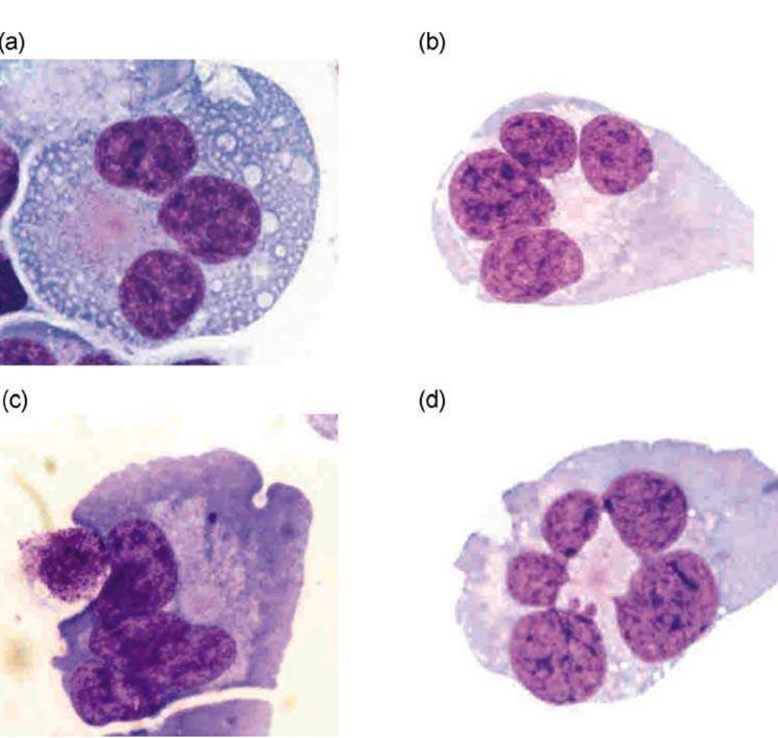 Figure 4 - from HUMN project: detailed description of the