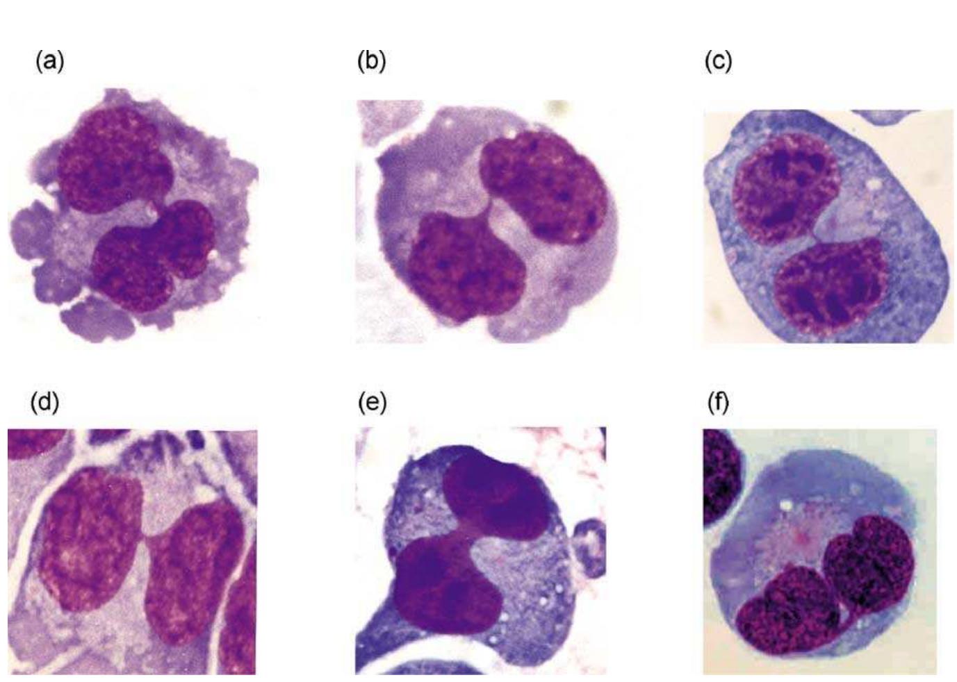 Figure 6 - from HUMN project: detailed description of the