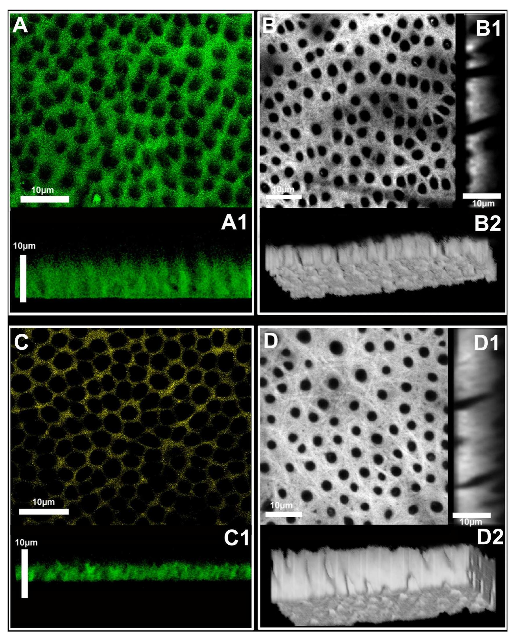 Stack Projection - dye-assisted calcium-staining confocal microscopy